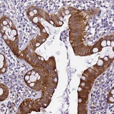 Immunohistochemistry: ZNF587 Antibody [NBP2-33387]