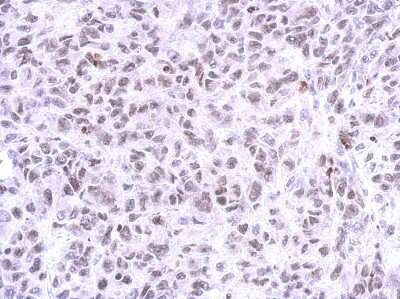 Immunohistochemistry-Paraffin: ZNF587 Antibody [NBP2-21030]