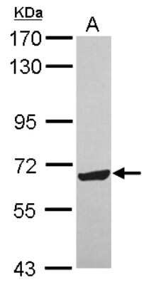 Western Blot: ZNF587 Antibody [NBP2-21030]