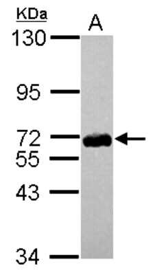 Western Blot: ZNF587 Antibody [NBP2-21031]