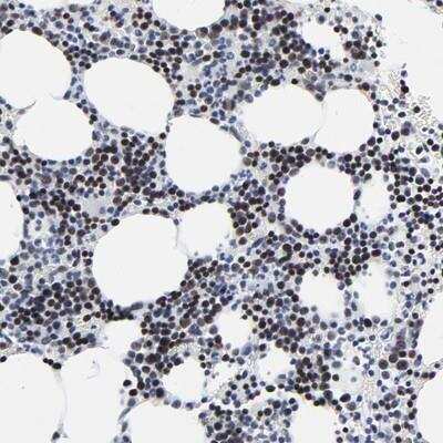 Immunohistochemistry-Paraffin: ZNF589 Antibody [NBP1-80707]