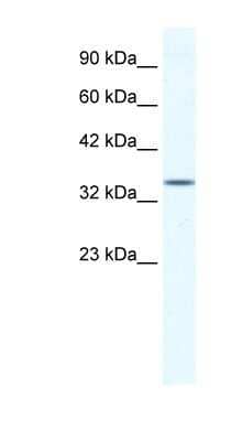 Western Blot: ZNF589 Antibody [NBP1-80274]