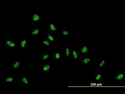 Immunocytochemistry/ Immunofluorescence: ZNF593 Antibody [H00051042-B01P]