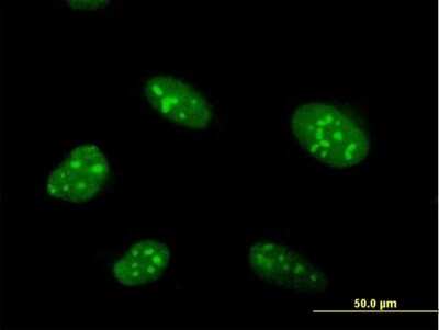 Immunocytochemistry/ Immunofluorescence: ZNF593 Antibody [H00051042-B02P]