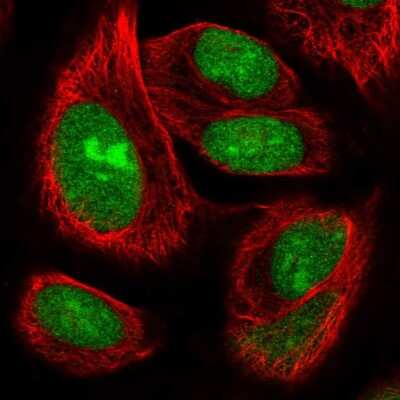 Immunocytochemistry/ Immunofluorescence: ZNF593 Antibody [NBP2-31766]