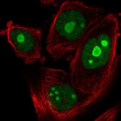 Immunocytochemistry/ Immunofluorescence: ZNF593 Antibody [NBP2-58075]