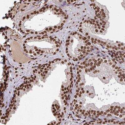 Immunohistochemistry-Paraffin: ZNF593 Antibody [NBP2-31766]