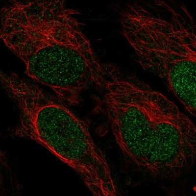 Immunocytochemistry/ Immunofluorescence: ZNF594 Antibody [NBP2-57914]