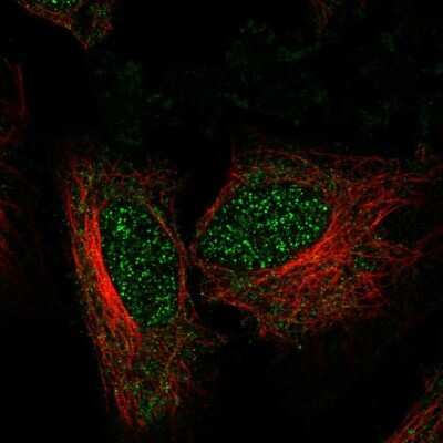 Immunocytochemistry/ Immunofluorescence: ZNF594 Antibody [NBP2-68759]