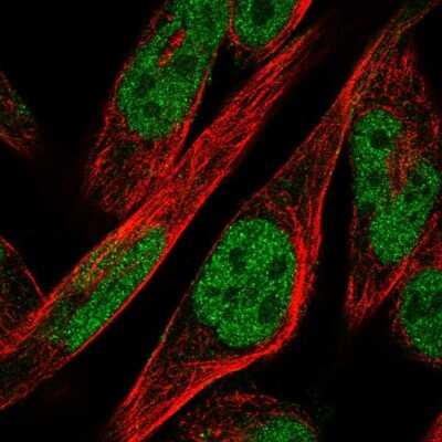 Immunocytochemistry/ Immunofluorescence: ZNF594 Antibody [NBP2-68883]