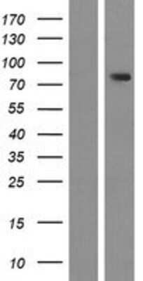 Western Blot: ZNF595 Overexpression Lysate [NBP2-04853]