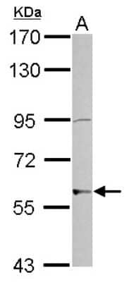 Western Blot: ZNF596 Antibody [NBP2-21032]