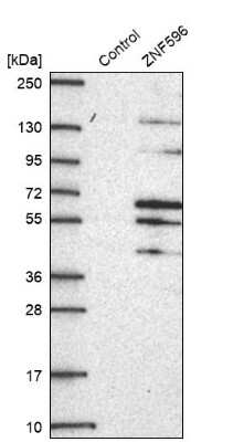 Western Blot: ZNF596 Antibody [NBP2-49183]