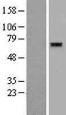 Western Blot: ZNF596 Overexpression Lysate [NBL1-18202]