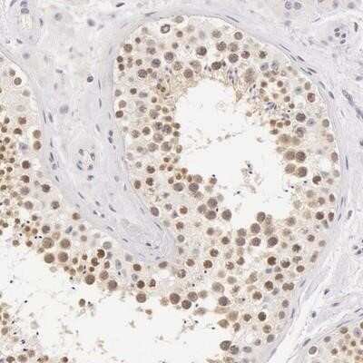 Immunohistochemistry-Paraffin: ZNF597 Antibody [NBP1-81982]