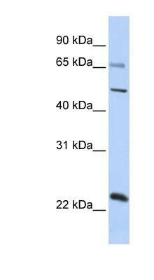 Western Blot: ZNF597 Antibody [NBP1-80158]