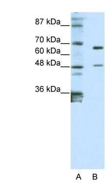 Western Blot: ZNF597 Antibody [NBP1-80408]