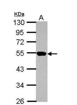 Western Blot: ZNF597 Antibody [NBP2-21033]