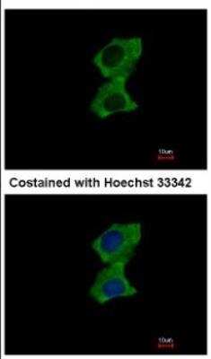 Immunocytochemistry/ Immunofluorescence: ZNF598 Antibody [NBP2-21035]