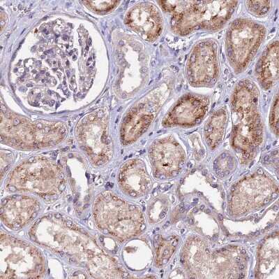 Immunohistochemistry-Paraffin: ZNF598 Antibody [NBP1-84658]