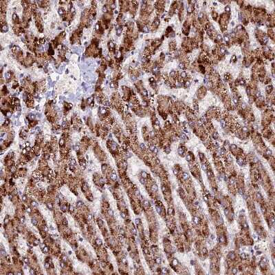 Immunohistochemistry-Paraffin: ZNF598 Antibody [NBP1-84658]