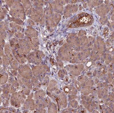Immunohistochemistry-Paraffin: ZNF598 Antibody [NBP1-84658]