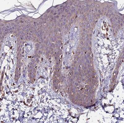 Immunohistochemistry-Paraffin: ZNF598 Antibody [NBP1-84658]