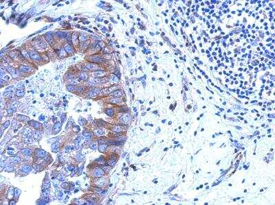 Immunohistochemistry-Paraffin: ZNF598 Antibody [NBP2-21035]