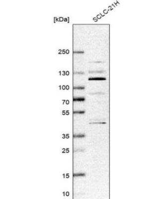 Western Blot: ZNF598 Antibody [NBP1-84659]