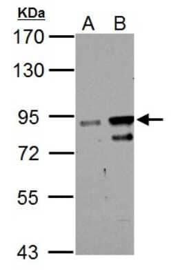 Western Blot: ZNF598 Antibody [NBP2-21034]