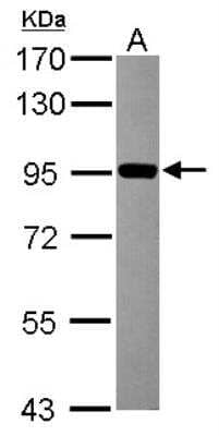 Western Blot: ZNF598 Antibody [NBP2-21035]