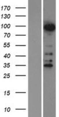 Western Blot: ZNF598 Overexpression Lysate [NBP2-04989]