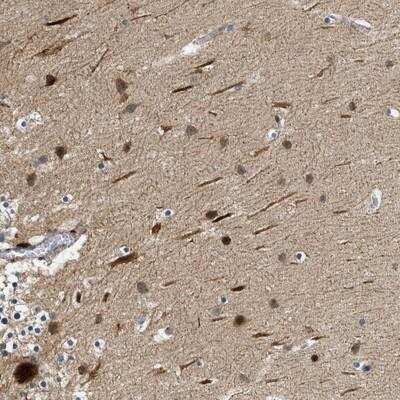 Immunohistochemistry-Paraffin: ZNF599 Antibody [NBP1-82038]