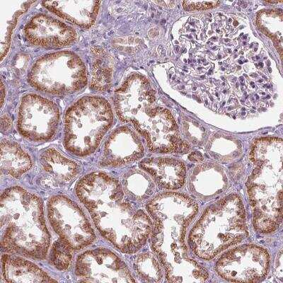 Immunohistochemistry: ZNF605 Antibody [NBP2-46868]