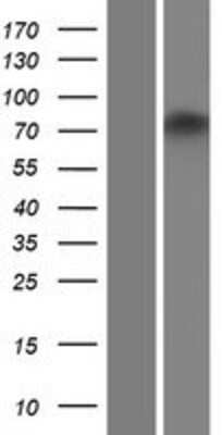 Western Blot: ZNF605 Overexpression Lysate [NBP2-04780]