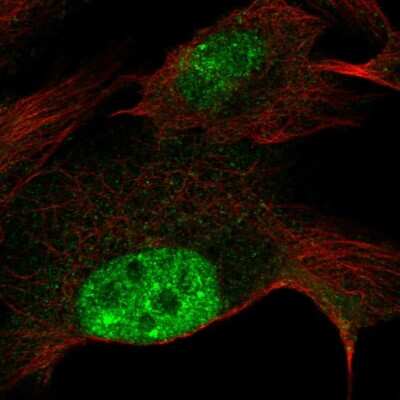 Immunocytochemistry/ Immunofluorescence: ZNF606 Antibody [NBP2-54926]