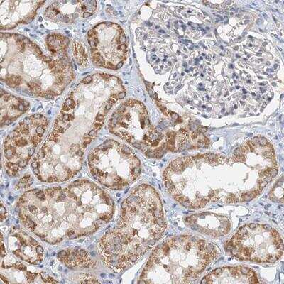 Immunohistochemistry-Paraffin: ZNF606 Antibody [NBP1-92632]