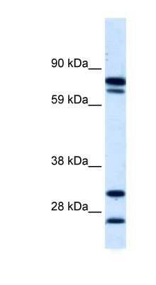 Western Blot: ZNF606 Antibody [NBP1-80028]