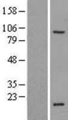 Western Blot: ZNF606 Overexpression Lysate [NBL1-18207]