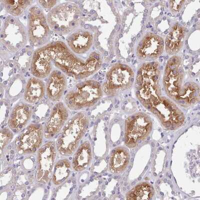 Immunohistochemistry-Paraffin: ZNF607 Antibody [NBP2-13586]