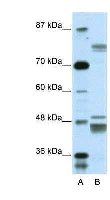 Western Blot: ZNF607 Antibody [NBP1-80125]