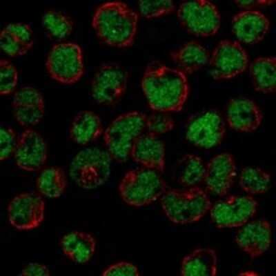 Immunocytochemistry/ Immunofluorescence: ZNF608 Antibody [NBP3-17565]