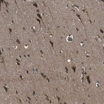 Immunohistochemistry-Paraffin: ZNF608 Antibody [NBP1-85109]