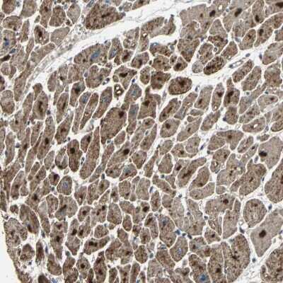 Immunohistochemistry-Paraffin: ZNF608 Antibody [NBP1-85109]
