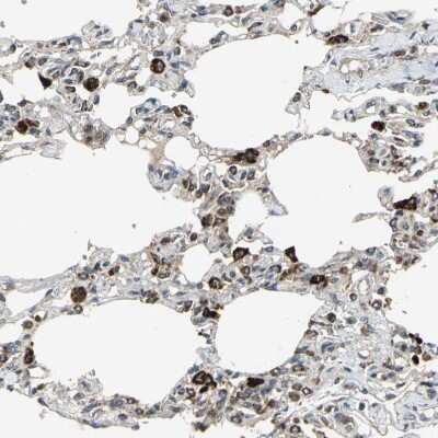 Immunohistochemistry-Paraffin: ZNF608 Antibody [NBP1-85109]