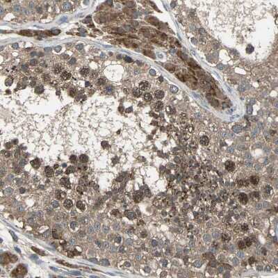 Immunohistochemistry-Paraffin: ZNF608 Antibody [NBP1-85109]