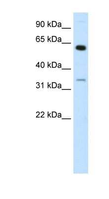 Western Blot: ZNF609 Antibody [NBP1-79981]