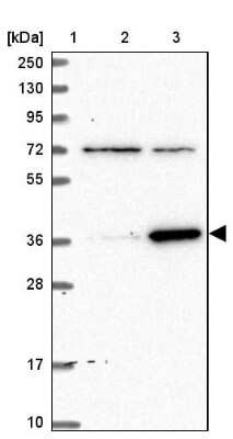 Western Blot: ZNF609 Antibody [NBP1-92634]