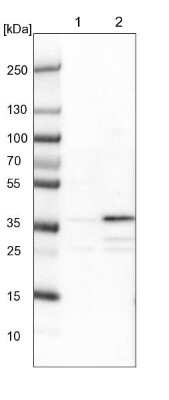 Western Blot: ZNF609 Antibody [NBP1-92634]