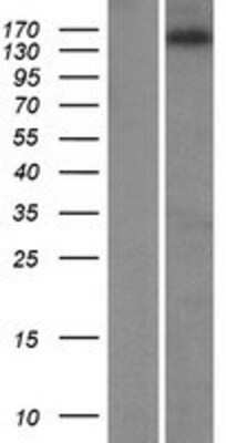 Western Blot: ZNF609 Overexpression Lysate [NBP2-07225]